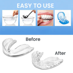 4Pcs Silicone Anti-Snoring Dental Guards Set