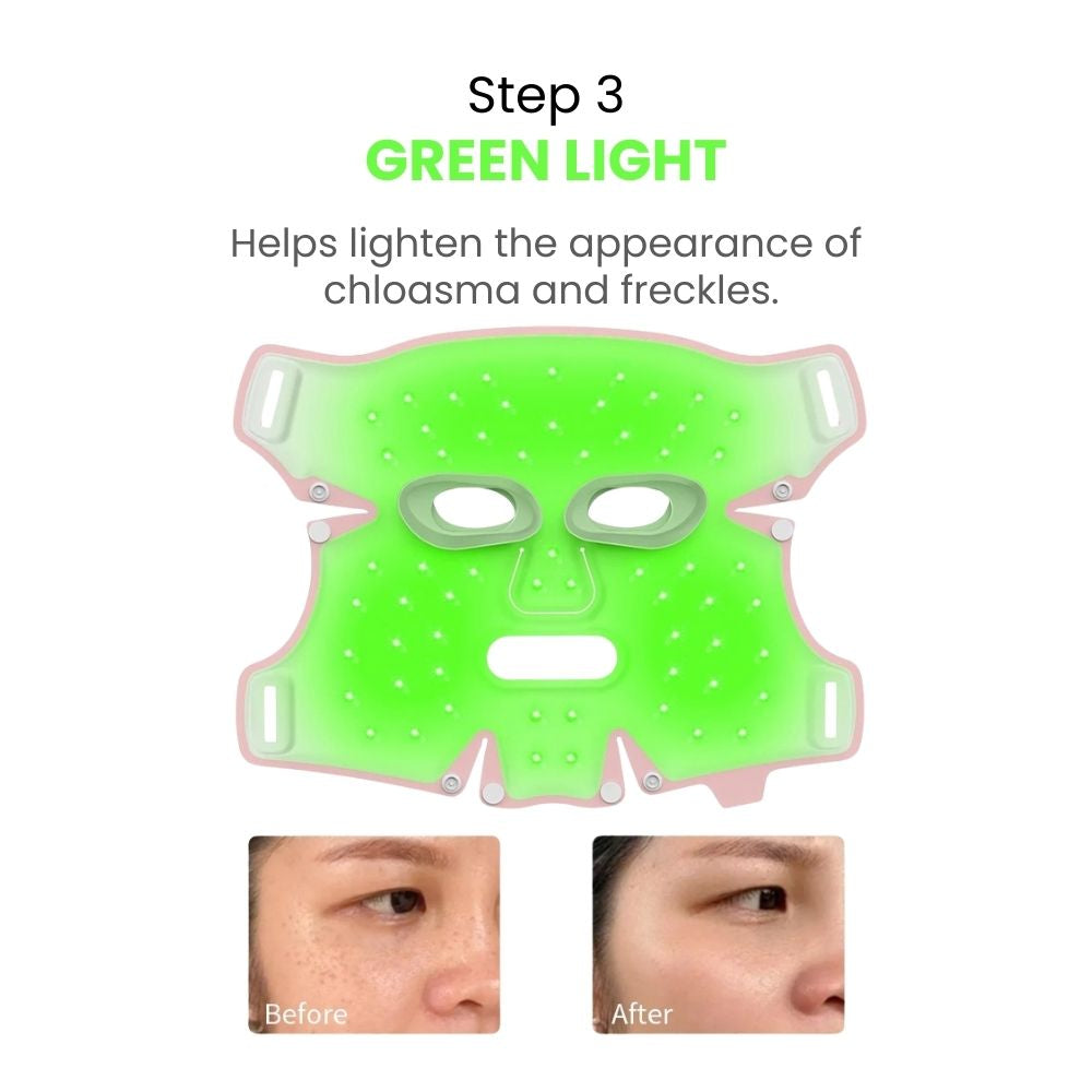 ANLAN 5-Color LED Therapy Silicone Facial Mask - step 3