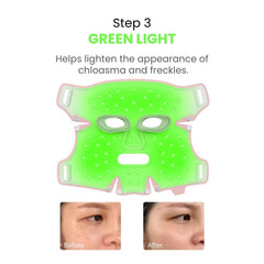 ANLAN 5-Color LED Therapy Silicone Facial Mask - step 3