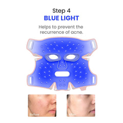 ANLAN 5-Color LED Therapy Silicone Facial Mask - step 4