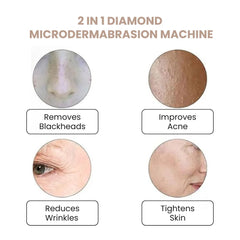 3 in 1 Microdermabrasion Vacuum & Spray Device - 2 in 1