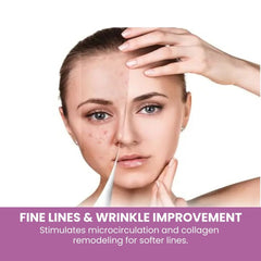 Diamond Microdermabrasion Facial Machine - wrinkle improvement