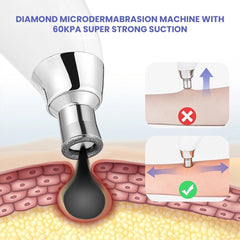 Diamond Microdermabrasion Facial Peeling Device 60KPa - 60KPA Super strong