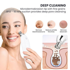 Diamond Peel Blackhead Remover — 2-in-1 Pore Vacuum