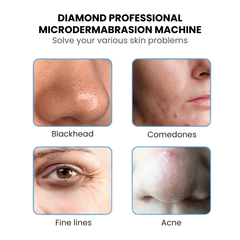 Diamond Microdermabrasion Facial Machine