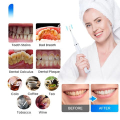 Electric Toothbrush Kit for Tartar Removal & Scaling