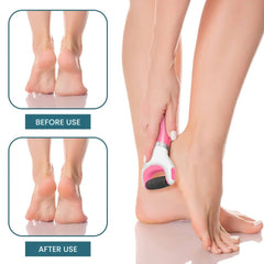 Foot File Electric Callus Remover – Easy Dead Skin Removal
