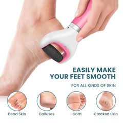 Foot File Electric Callus Remover – Easy Dead Skin Removal