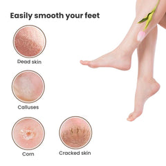 Foot Spa Kit 8-in-1 – Dead Skin Remover & Pedicure Tools