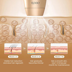 High-End Ice Laser IPL Hair Removal Device – 4-in-1 Face & Body