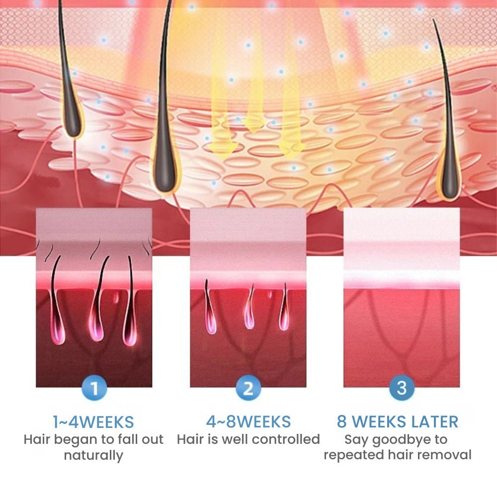 IPL Hair Removal Handset – Ice-Cold, Painless, 500K Flashes - features