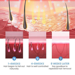 IPL Hair Removal Handset – Ice-Cold, Painless, 500K Flashes - features