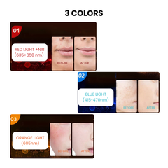 Infrared LED Face & Neck Mask — 170-Lamp NIR Therapy