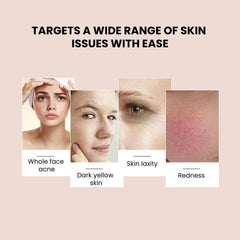 LED 7-Color Photon Facial Mask — Anti-Aging & Acne - wide range