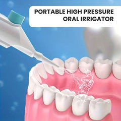 Portable High Pressure Oral Irrigator for Deep Teeth Cleaning