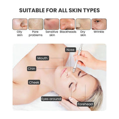 Pro Hydra Microdermabrasion Facial Vacuum Machine -  for all skin