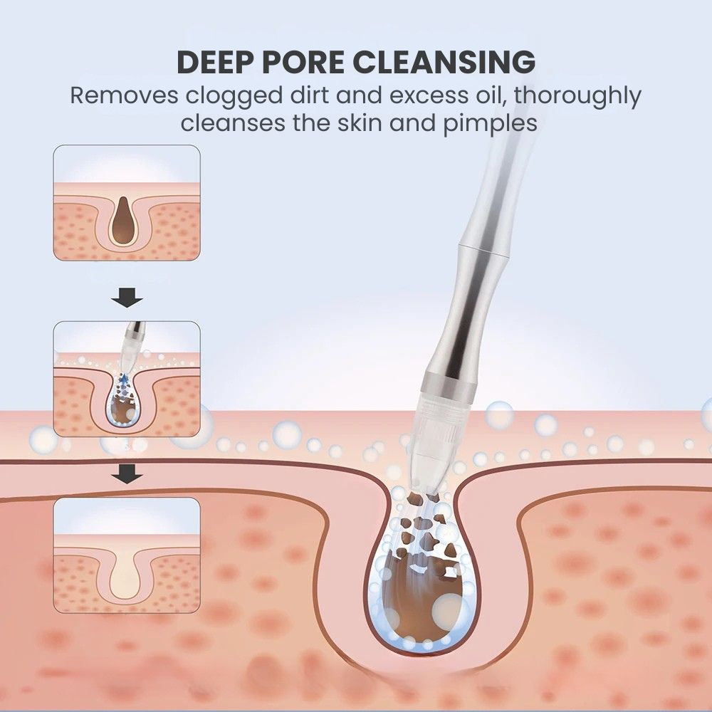 Pro Hydra Microdermabrasion Facial Vacuum Machine - Deep pore cleaning