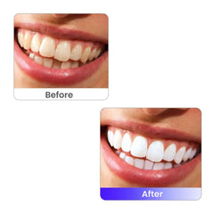 Pro LED Teeth Whitening Lamp - Cold Light Dental Machine