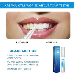 Purple Teeth Whitening Pen for Stain Removal & Fresh Breath