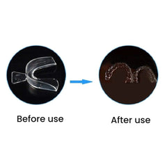 Soft Silicone Dental Mouth Guard & Whitening Tray Set