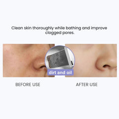 Ultrasonic Skin Scrubber — 24KHz Deep Pore Cleanser - clean skin
